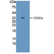 Western blot analysis of recombinant Human SST.