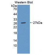 Western blot analysis of recombinant Human ULBP2.