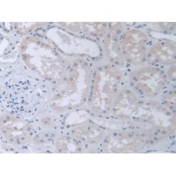Chaperonin Containing TCP1, Subunit 2 (CCT2) Antibody
