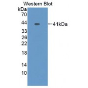 Western blot analysis of recombinant Human PK2 Protein (with N-terminal His and GST tags).