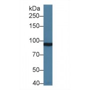 Western blot analysis of Rat Cerebrum lysate, using Human GRM3 Antibody (1 µg/ml) and HRP-conjugated Goat Anti-Rabbit antibody (<a href="https://www.abbexa.com/index.php?route=product/search&amp;search=abx400043" target="_blank">abx400043</a>, 0.2 µg/ml).