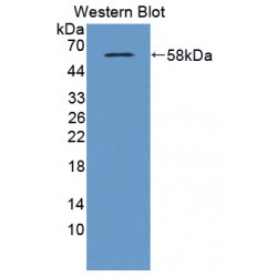 Glutamate Receptor, Metabotropic 3 (GRM3) Antibody