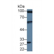 Western blot analysis of Human U2OS cell lysate, using Human DBN1 Antibody (3 µg/ml) and HRP-conjugated Goat Anti-Rabbit antibody (<a href="https://www.abbexa.com/index.php?route=product/search&amp;search=abx400043" target="_blank">abx400043</a>, 0.2 µg/ml).