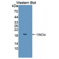 Drebrin 1 (DBN1) Antibody