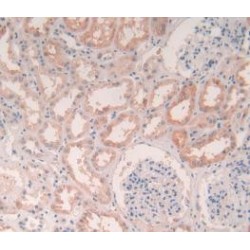 Legumain (LGMN) Antibody