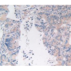 Legumain (LGMN) Antibody