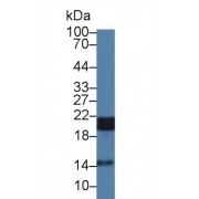 Western blot analysis of Pig Skeletal muscle lysate, using Human HSPB7 Antibody (1 µg/ml) and HRP-conjugated Goat Anti-Rabbit antibody (<a href="https://www.abbexa.com/index.php?route=product/search&amp;search=abx400043" target="_blank">abx400043</a>, 0.2 µg/ml).