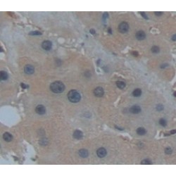 Phosphoglycerate Mutase 1, Brain (PGAM1) Antibody