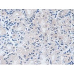 Transitional Endoplasmic Reticulum ATPase (VCP) Antibody