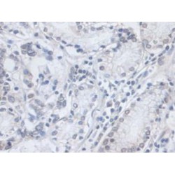 Transitional Endoplasmic Reticulum ATPase (VCP) Antibody