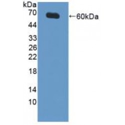 Inhibitor of Apoptosis Protein, X-Linked (XIAP) Antibody