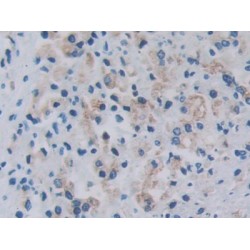 Arginine--tRNA Ligase, Cytoplasmic (RARS1) Antibody