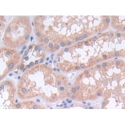 Protein Tyrosine Phosphatase, Non Receptor Type 6 (PTPN6) Antibody