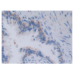 Topoisomerase III (TOP3) Antibody