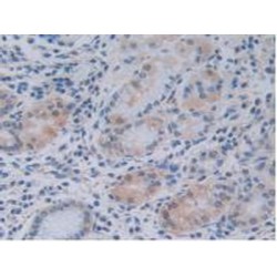 Tumor Necrosis Factor Ligand Superfamily Member 9 (TNFSF9) Antibody