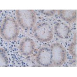 Tumor Necrosis Factor Ligand Superfamily Member 9 (TNFSF9) Antibody