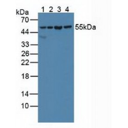 Serine Hydroxymethyltransferase 2, Mitochondrial (SHMT2) Antibody