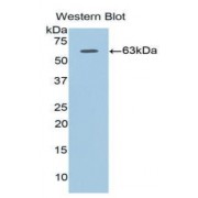 Western blot analysis of recombinant Human ADIPOR1.