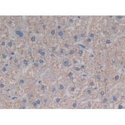Chemokine C-C-Motif Ligand 3 Like Protein 1 (CCL3L1) Antibody