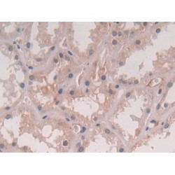Interleukin 5 (IL5) Antibody