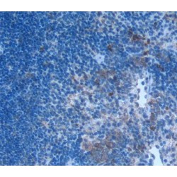 Macrophage Inflammatory Protein 1 Alpha (MIP1a) Antibody