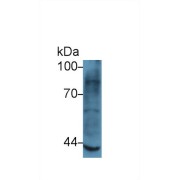 Western blot analysis of Rat Skeletal muscle lysate, using Human MMP3 Antibody (5 µg/ml) and HRP-conjugated Goat Anti-Rabbit antibody (<a href="https://www.abbexa.com/index.php?route=product/search&amp;search=abx400043" target="_blank">abx400043</a>, 0.2 µg/ml).