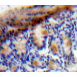 Vascular Endothelial Growth Factor C (VEGFC) Antibody