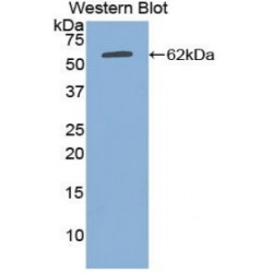 Alpha-2-Heremans Schmid Glycoprotein (AHSG) Antibody