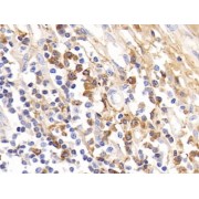 IHC-P analysis of Human Tonsil Tissue, with DAB staining.