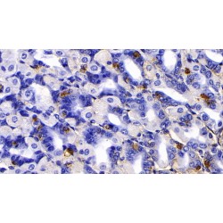 Immunoglobulin G4 (IgG4) Antibody