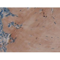 Collagen Type I Alpha 1 (COL1A1) Antibody