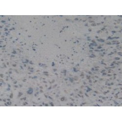 High Mobility Group Protein B1 (HMGB1) Antibody