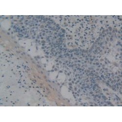 High Mobility Group Protein B1 (HMGB1) Antibody