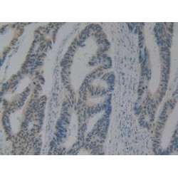 High Mobility Group Protein B1 (HMGB1) Antibody
