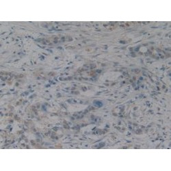 High Mobility Group Protein B1 (HMGB1) Antibody