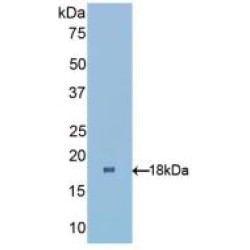 Retinol-Binding Protein 1 (RBP1) Antibody