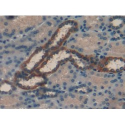 Retinol-Binding Protein 1 (RBP1) Antibody