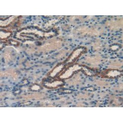 Retinol-Binding Protein 1 (RBP1) Antibody