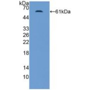 abx128518