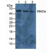 Western blot analysis of (1) Human A549 Cells, (2) Human HepG2 Cells and (3) Human HeLa cells.