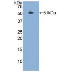 Pyruvate Kinase, Muscle (PKM2) Antibody