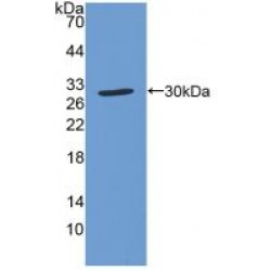 Superoxide Dismutase Copper Chaperone (CCS) Antibody