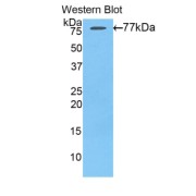 Western blot analysis of the recombinant protein.