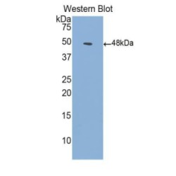 Activin A Receptor Type I (ACVR1) Antibody