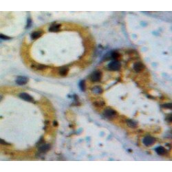 Activin A Receptor Type I (ACVR1) Antibody