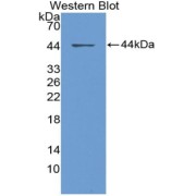 Western blot analysis of the recombinant protein.