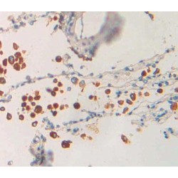 Phospholipase A1 (PLA1) Antibody