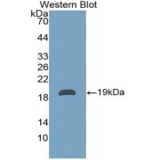 Western blot analysis of the recombinant protein.