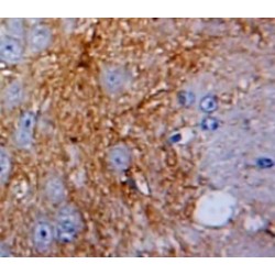 Pleiotrophin (PTN) Antibody
