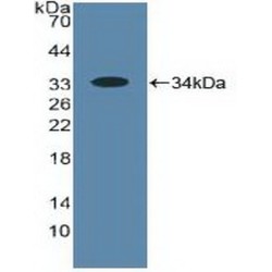 Polyunsaturated Fatty Acid 5-Lipoxygenase (ALOX5) Antibody